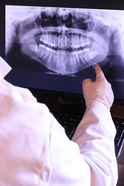 Best Emergency Dentist for Lost Fillings or Crowns in Home, WA