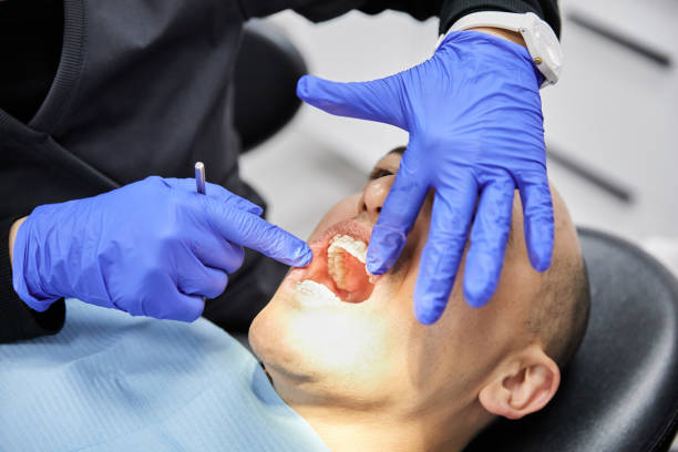 Best Emergency Dentist for Knocked-Out Tooth in Home, WA